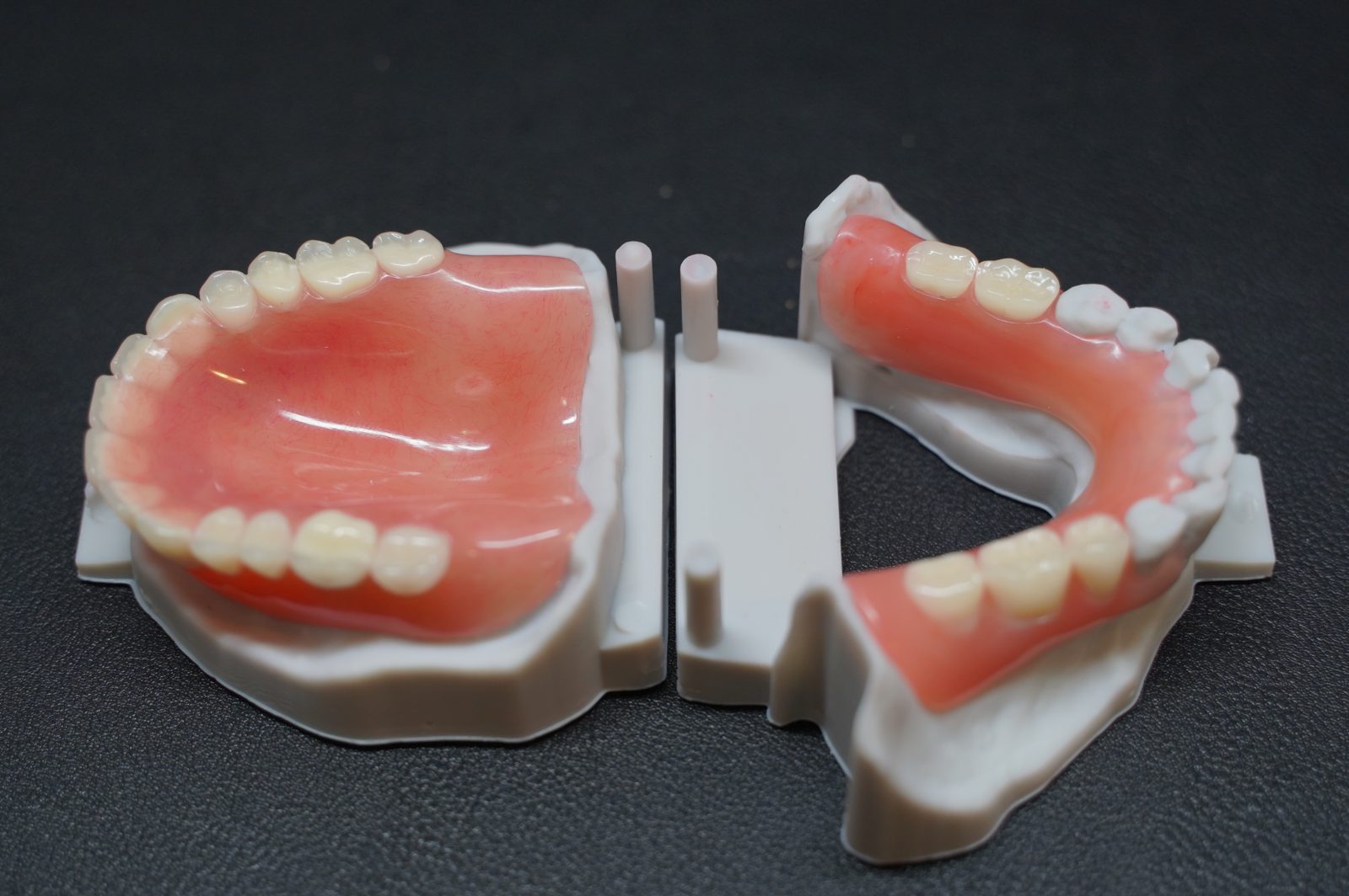HiZir custom dental prosthetics — complete and partial denture set