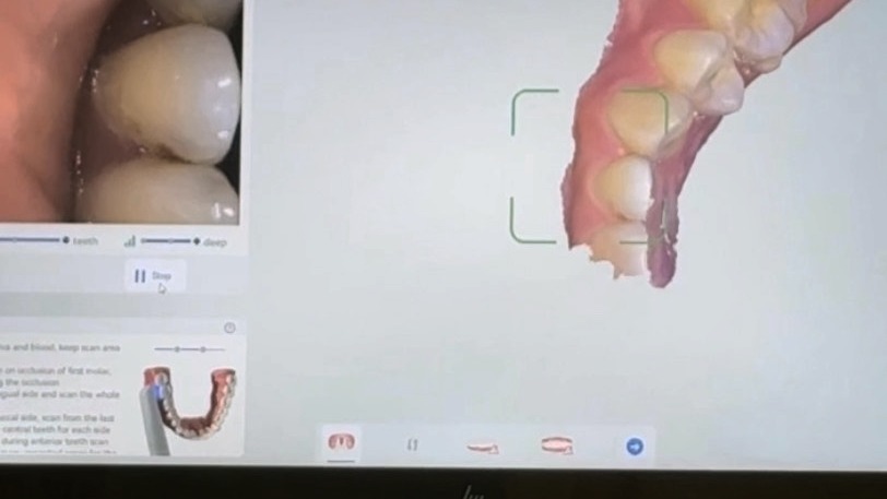 HiZir scanning software building a full-color 3D model in real time