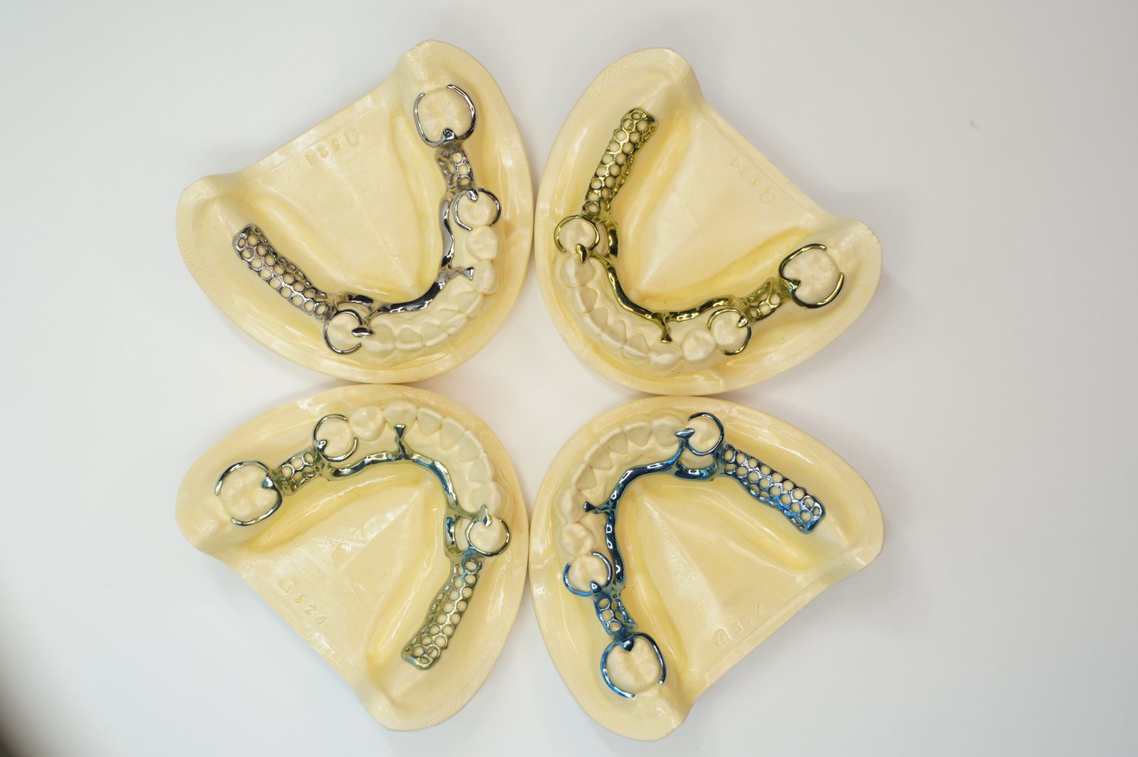 Space Ti RPD frameworks with silver, gold, and blue ionization color finishes