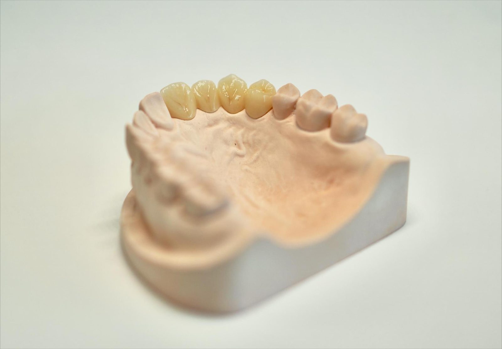 Zirconia crowns seated on a working model